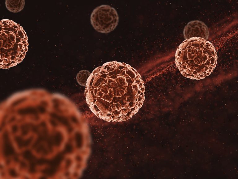 Bouche sèche (xérostomie) : causes, conséquences et solutions