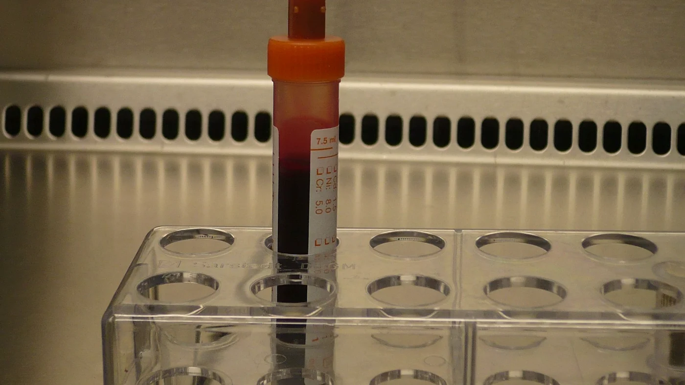 Tube de prélèvement sanguin pour un bilan lipidique
